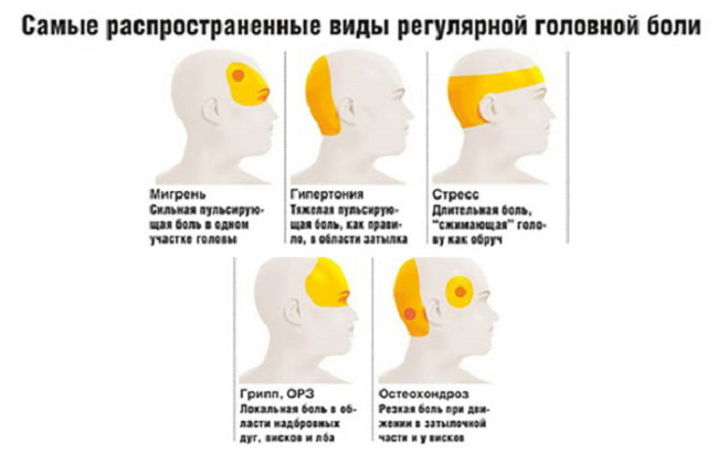 При кашле болит голова. Самый распространенный вид головной боли. Болит затылок головы таблетки. Головная боль давление. Головная боль как избавиться.